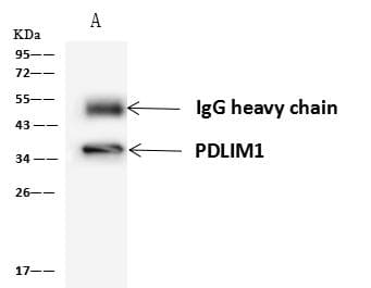 Polyclonal Rabbit anti-Human PDLIM1 Antibody (WB)