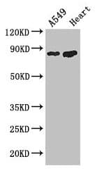 PFKM / PFK-1 Antibody