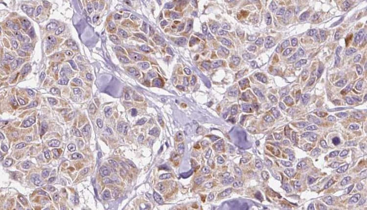CCL3 / MIP-1-Alpha Antibody