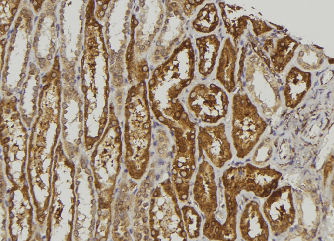 Polyclonal Rabbit anti-Human SLK Antibody (IHC, IF, WB)