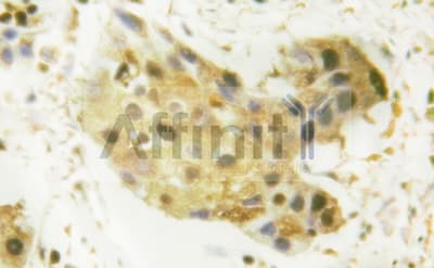 TP53 / p53 Antibody (phospho-Ser392)