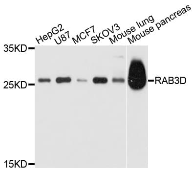 Polyclonal Rabbit anti-Human RAB3D Antibody (WB)