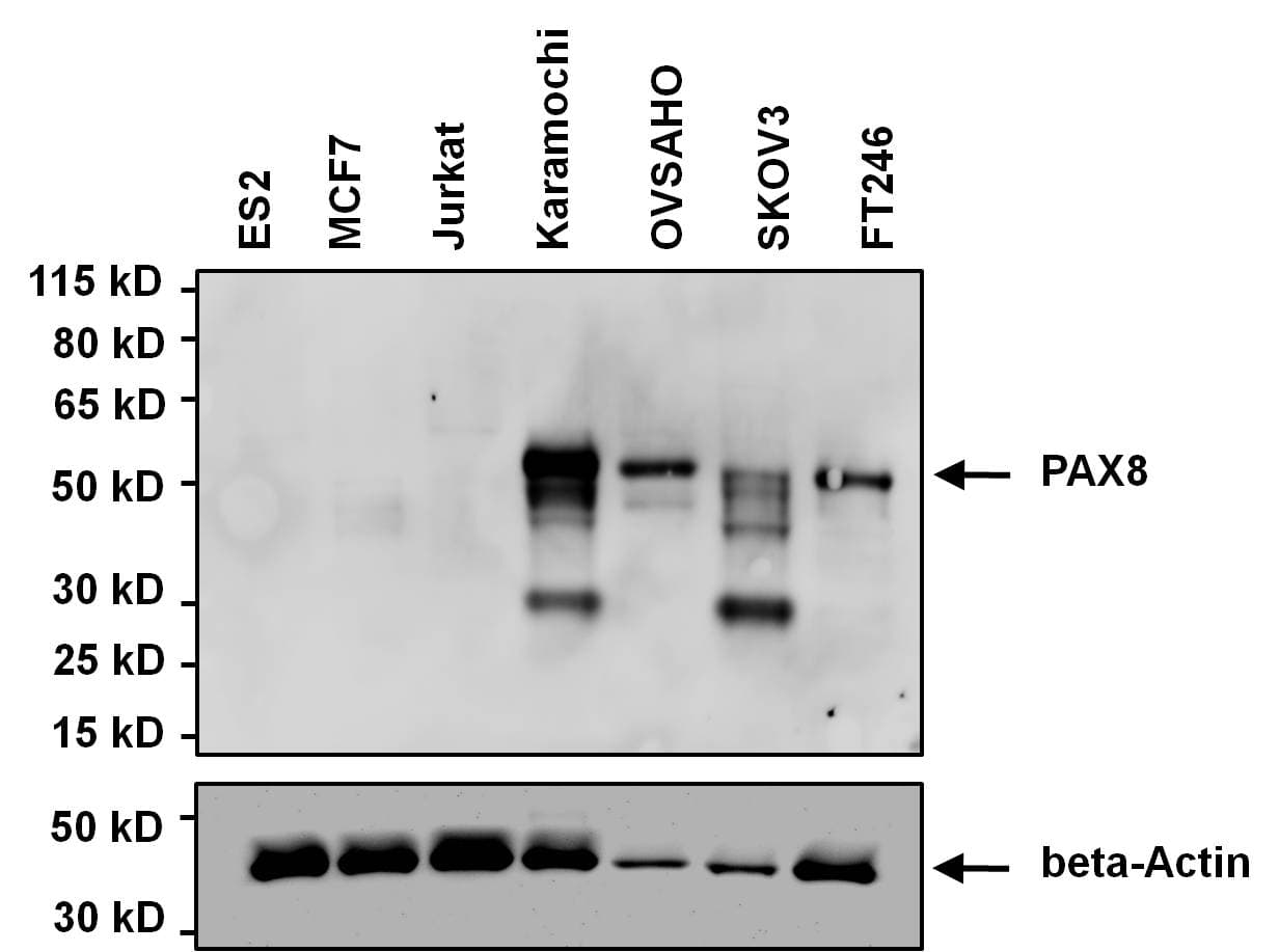 IHC-plus™ Monoclonal Mouse anti-Human PAX8 Antibody (clone 1F8-3A8, IHC, IF, WB)