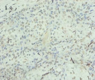 IL8 / Interleukin 8 Antibody