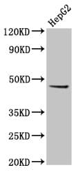 Polyclonal Rabbit anti-Human EPSTI1 Antibody (IHC, WB)