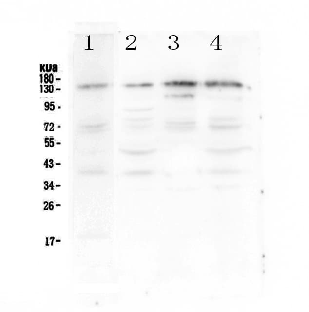 Polyclonal Rabbit anti-Human EPS15 Antibody (WB)