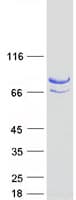 Human ZBED1 / TRAMP Protein (Recombinant Myc-DDK (Flag))