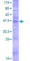 Human TMBIM6 / Bax Inhibitor 1 Protein (Recombinant GST)