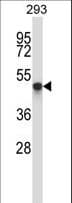 Polyclonal Rabbit anti-Human TOM1L1 Antibody (aa445-474, WB)