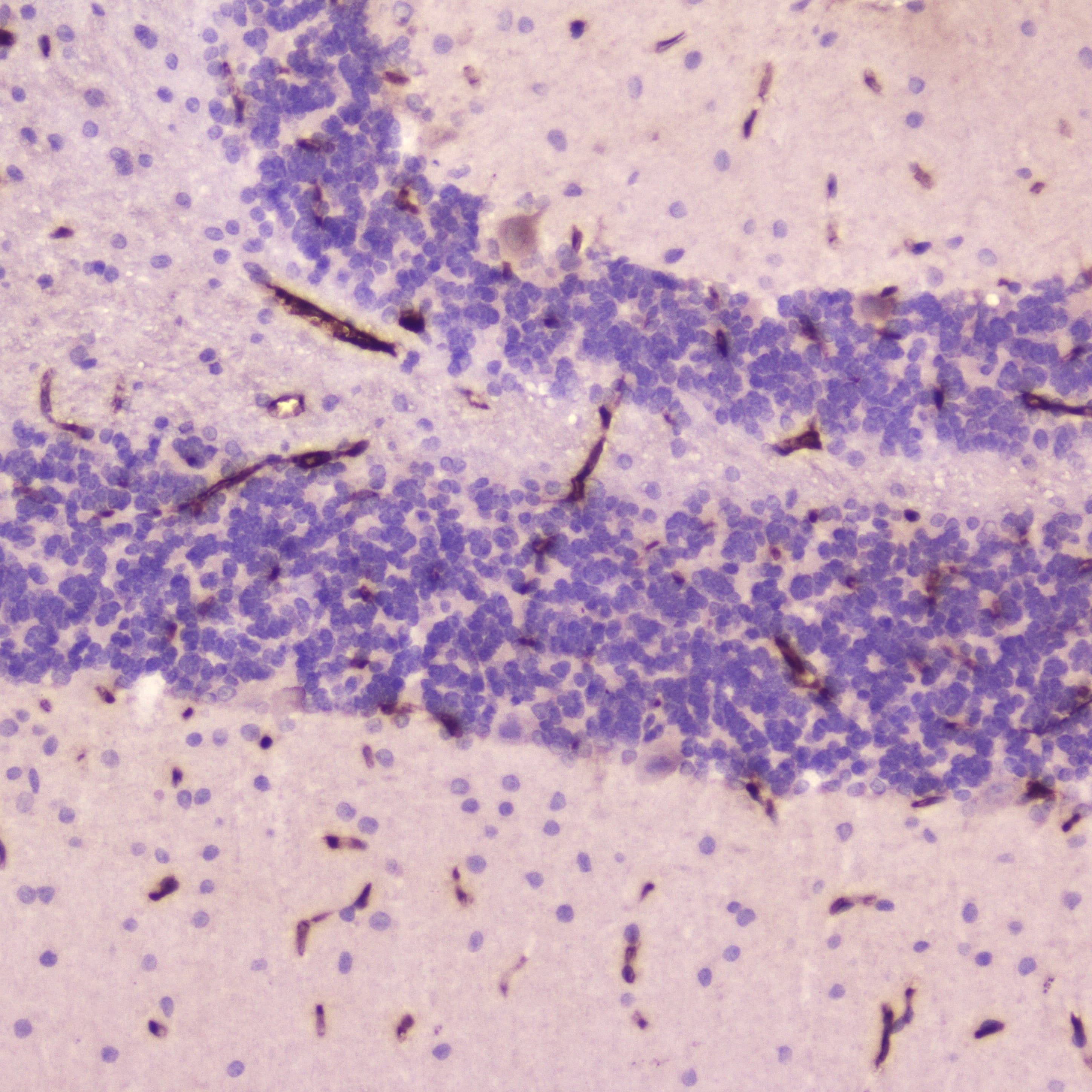 Polyclonal Rabbit anti-Rat CRP / C-Reactive Protein Antibody (IHC, WB)