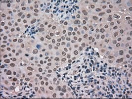 NEK6 Antibody (clone OTI8G5)