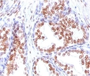 AR / Androgen Receptor Antibody (clone DHTR/882)