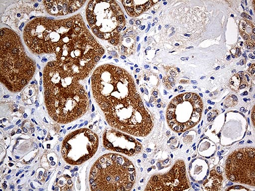 Monoclonal Mouse anti-Human FHIT Antibody (clone OTI2C2, IHC, WB)