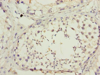 DNAL4 / Dynein Light Chain 4 Antibody