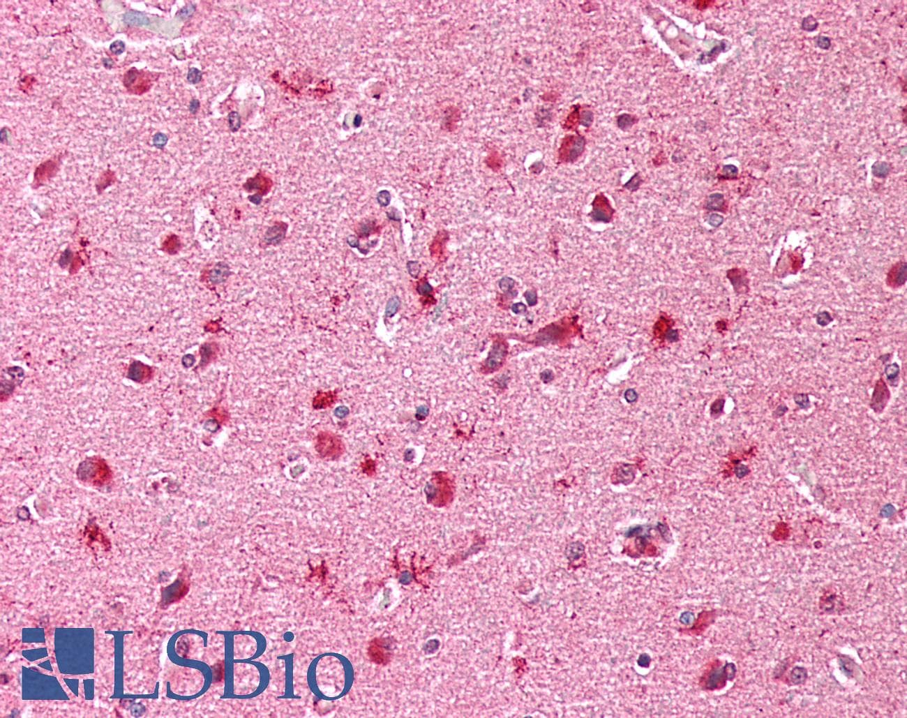 IHC-plus™ Polyclonal Rabbit anti-Human HBXIP Antibody (IHC, WB)