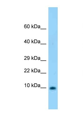 Polyclonal Rabbit anti-Rat S100B / S100 Beta Antibody (aa27-76, WB)