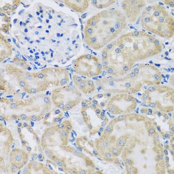 DCP2 Antibody