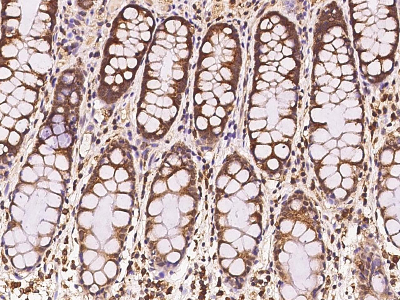 Polyclonal Rabbit anti-Human TANGO / MIA3 Antibody (IHC, IF)