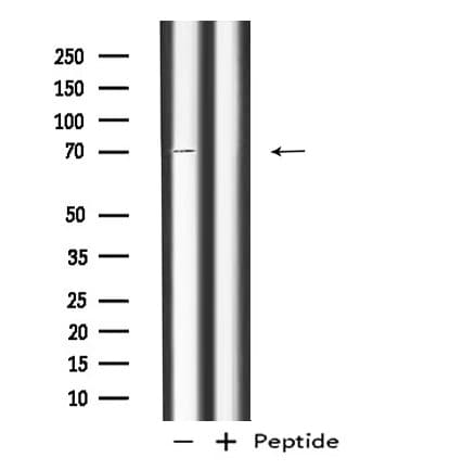 RAP1GAP Antibody