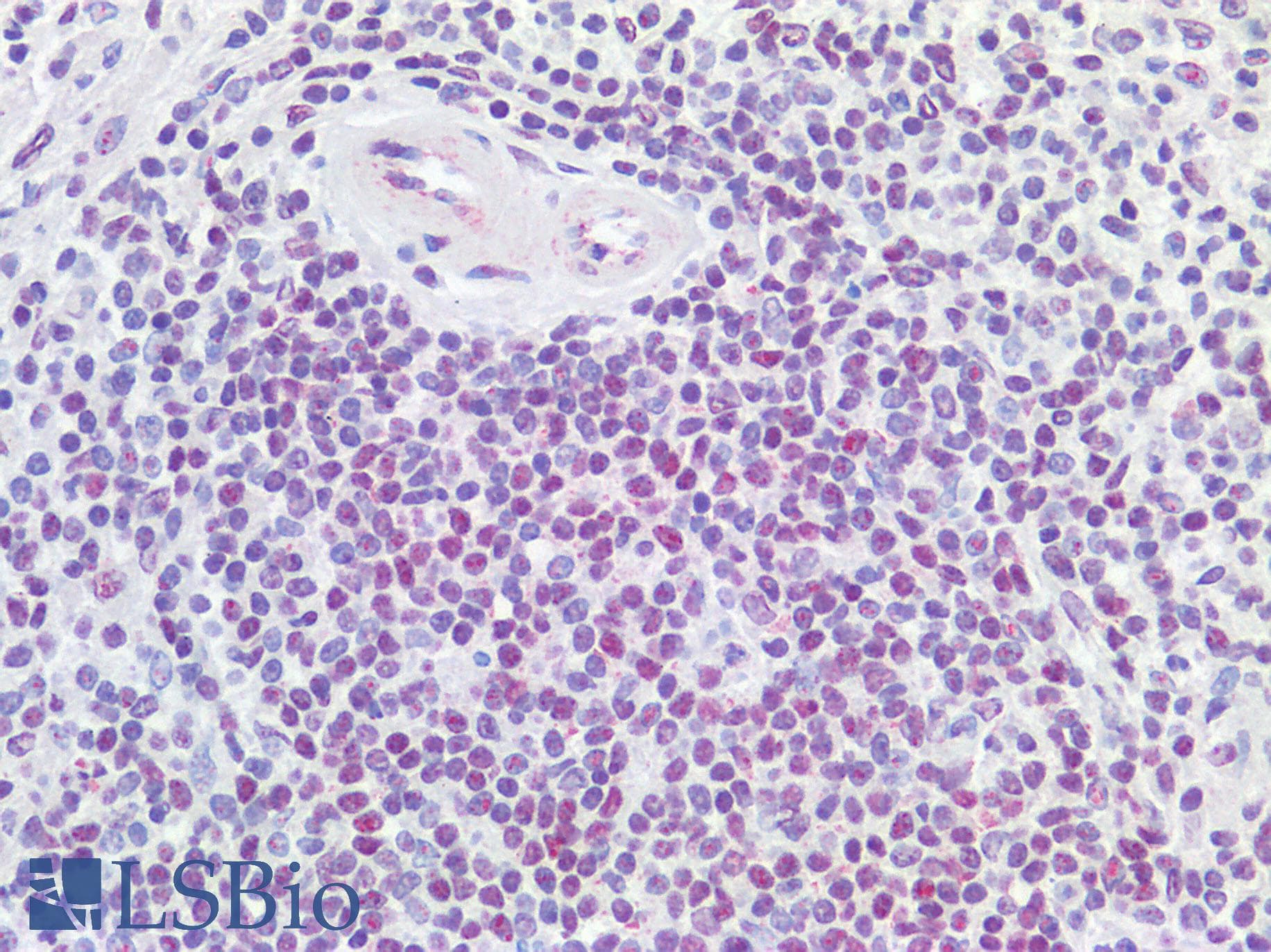IHC-plus™ SNAI1 / SNAIL-1 Antibody (N-Terminus)