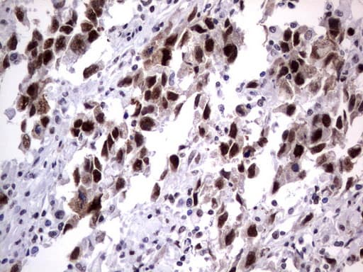 DDX56 Antibody (aa323-547, clone UMAB153)