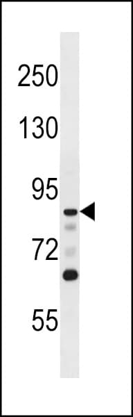 DCLK / DCLK1 Antibody (aa1-30)