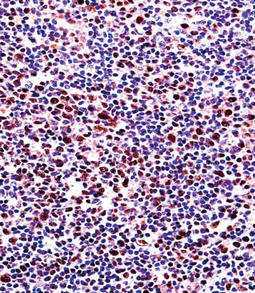 CBFA1 / RUNX2 Antibody (Ser533)