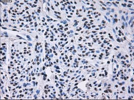 RPA2 / RFA2 / RPA34 Antibody (clone OTI1H10)