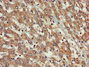 Polyclonal Rabbit anti-Human FARP1 / CDEP Antibody