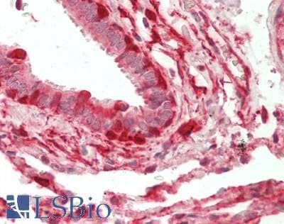IHC-plus™ ADH7 Antibody