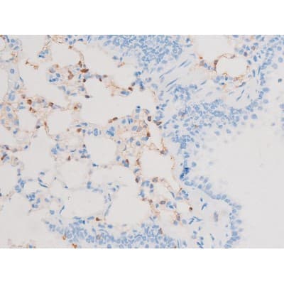 PRKCQ / PKC-Theta Antibody (phospho-Ser676)