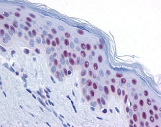 MRE11A / MRE11 Antibody