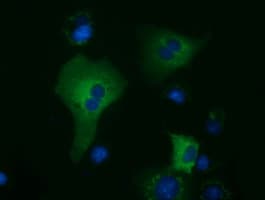 KLHL2 / MAV Antibody (aa1-100, clone OTI3H9, Carrier-free)