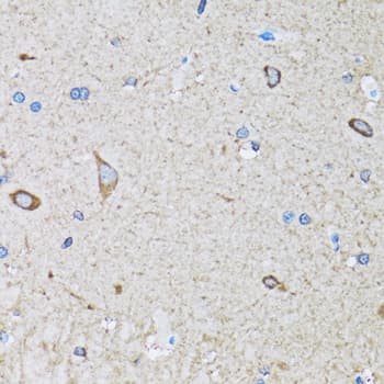 HIP1 Antibody