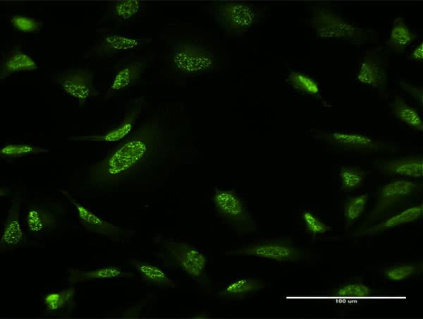 ZBTB25 Antibody (clone 2E8)