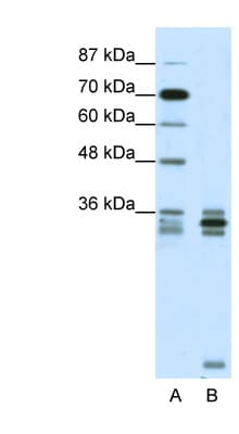 OLIG2 Antibody (aa236-285)