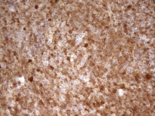 IHC-plus™ LGALS9 / Galectin 9 Antibody (clone 2A4)