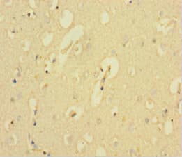 KCNMA1 / BK Antibody