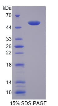 Mouse CD40L Protein (Recombinant His-GST)