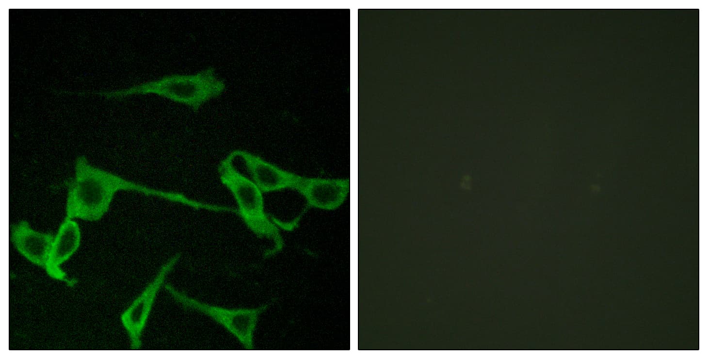 HRH2 / Histamine H2 Receptor Antibody (aa131-180)