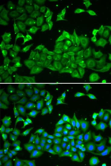 ALDH3A1 Antibody