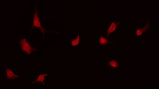 p56lck / LCK Antibody (phospho-Ser59)