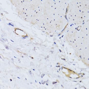 PECAM-1 / CD31 Antibody
