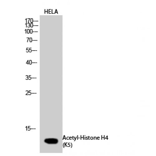 Polyclonal Rabbit anti-Human Histone H4 Antibody (1-80 aa, IHC, IF, WB)