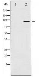 PR / Progesterone Receptor Antibody