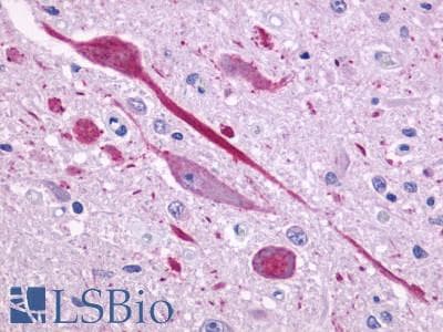 PathPlus™ P2RY14 / GPR105 Antibody (C-Terminus)