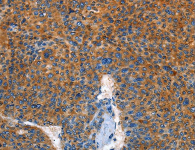 AUP1 Antibody