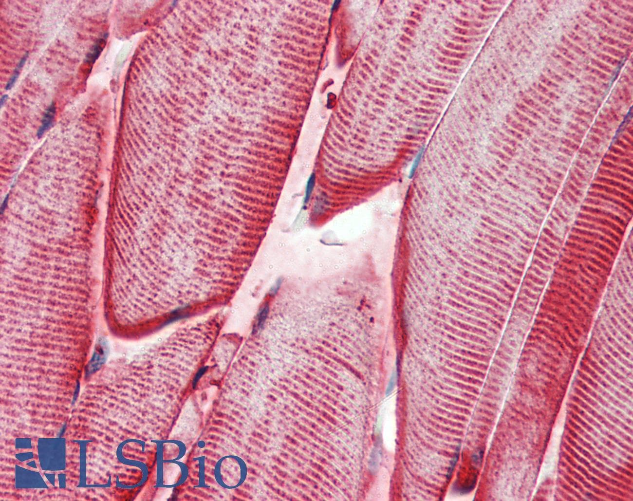 IHC-plus™ CRYAB / Alpha B Crystallin Antibody (clone 1D11C6E6)