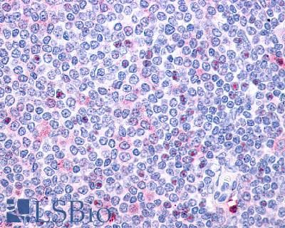 IHC-plus™ Polyclonal Rabbit anti-Human P2Y10 / P2RY10 Antibody (C-Terminus, IHC)