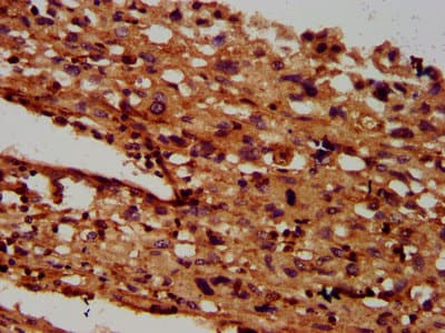 SGCB / SGC / Sarcoglycan Beta Antibody